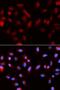 Baculoviral IAP Repeat Containing 5 antibody, LS-C331536, Lifespan Biosciences, Immunofluorescence image 