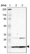 Dynein Axonemal Light Chain 4 antibody, NBP1-84227, Novus Biologicals, Western Blot image 