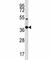 Homeobox protein Nkx-2.2 antibody, F42417-0.4ML, NSJ Bioreagents, Western Blot image 