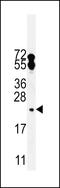 Cytosolic Iron-Sulfur Assembly Component 2A antibody, 55-736, ProSci, Western Blot image 
