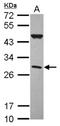 Complement Factor H Related 2 antibody, NBP2-14911, Novus Biologicals, Western Blot image 