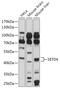 SET Domain Containing 4 antibody, 18-058, ProSci, Western Blot image 