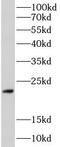 Phospholamban antibody, FNab09994, FineTest, Western Blot image 