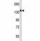 Insulin Receptor antibody, F44014-0.4ML, NSJ Bioreagents, Western Blot image 