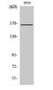 FA Complementation Group D2 antibody, A00563, Boster Biological Technology, Western Blot image 