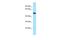 Actin Related Protein 6 antibody, A14200, Boster Biological Technology, Western Blot image 