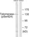 Telomerase Reverse Transcriptase antibody, LS-C199643, Lifespan Biosciences, Western Blot image 