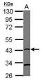 RAD51 Recombinase antibody, GTX70296, GeneTex, Western Blot image 