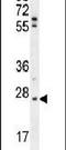 TNF Alpha Induced Protein 8 antibody, PA5-24449, Invitrogen Antibodies, Western Blot image 