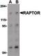 Regulatory Associated Protein Of MTOR Complex 1 antibody, PA5-20126, Invitrogen Antibodies, Western Blot image 