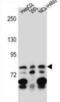 Zinc Finger Protein 555 antibody, abx027298, Abbexa, Western Blot image 