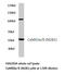Calcium/Calmodulin Dependent Protein Kinase II Alpha antibody, LS-C177502, Lifespan Biosciences, Western Blot image 