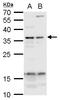 Upstream Transcription Factor 1 antibody, GTX129467, GeneTex, Western Blot image 