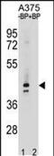 Olfactory Receptor Family 5 Subfamily AC Member 2 antibody, PA5-49254, Invitrogen Antibodies, Western Blot image 