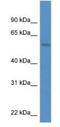 MON1 Homolog A, Secretory Trafficking Associated antibody, NBP1-74123, Novus Biologicals, Western Blot image 