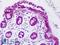 Superoxide Dismutase 2 antibody, LS-B9291, Lifespan Biosciences, Immunohistochemistry paraffin image 