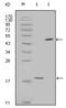 Baculoviral IAP Repeat Containing 5 antibody, STJ98403, St John