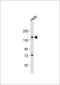 Podocalyxin Like antibody, 60-255, ProSci, Western Blot image 