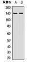 Zinc Finger CCCH-Type Containing 4 antibody, LS-C368549, Lifespan Biosciences, Western Blot image 