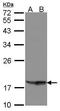 Phospholipase A And Acyltransferase 4 antibody, PA5-21863, Invitrogen Antibodies, Western Blot image 