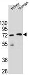Potassium Channel Tetramerization Domain Containing 8 antibody, AP52325PU-N, Origene, Western Blot image 