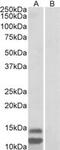 Cyclin Dependent Kinase Inhibitor 2B antibody, MBS423455, MyBioSource, Western Blot image 