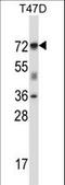Forkhead Box K2 antibody, LS-C166231, Lifespan Biosciences, Western Blot image 