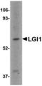 Leucine Rich Glioma Inactivated 1 antibody, LS-C53265, Lifespan Biosciences, Western Blot image 