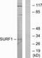 SURF1 Cytochrome C Oxidase Assembly Factor antibody, TA314580, Origene, Western Blot image 