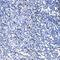 RAD18 E3 Ubiquitin Protein Ligase antibody, A01622-2, Boster Biological Technology, Immunohistochemistry paraffin image 