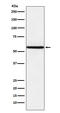 Nuclear Receptor Subfamily 1 Group D Member 1 antibody, M01077-1, Boster Biological Technology, Western Blot image 
