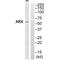 Aristaless Related Homeobox antibody, A06388, Boster Biological Technology, Western Blot image 