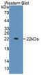 PHD Finger Protein 8 antibody, abx131696, Abbexa, Western Blot image 