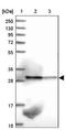 Translocase Of Inner Mitochondrial Membrane 29 antibody, NBP1-94151, Novus Biologicals, Western Blot image 