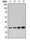 APAF1 Interacting Protein antibody, LS-C482771, Lifespan Biosciences, Western Blot image 