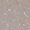Menin 1 antibody, NBP1-90357, Novus Biologicals, Immunohistochemistry paraffin image 