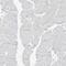Asparaginase Like 1 antibody, HPA029725, Atlas Antibodies, Immunohistochemistry frozen image 
