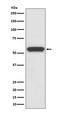 Cytochrome P450 Family 19 Subfamily A Member 1 antibody, M00071, Boster Biological Technology, Western Blot image 