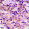 Autophagy Related 4B Cysteine Peptidase antibody, LS-C354558, Lifespan Biosciences, Immunohistochemistry paraffin image 