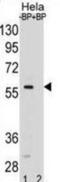 Mothers against decapentaplegic homolog 5 antibody, abx031222, Abbexa, Western Blot image 
