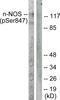 Nitric Oxide Synthase 1 antibody, PA5-38305, Invitrogen Antibodies, Western Blot image 