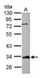 ETS Variant 7 antibody, GTX116171, GeneTex, Western Blot image 