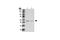 BLK Proto-Oncogene, Src Family Tyrosine Kinase antibody, 3262S, Cell Signaling Technology, Western Blot image 