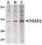 TNF receptor-associated factor 2 antibody, PA5-20193, Invitrogen Antibodies, Western Blot image 