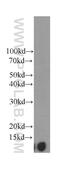 Beta-2-Microglobulin antibody, 66207-1-Ig, Proteintech Group, Western Blot image 