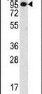 Collagen Type IX Alpha 1 Chain antibody, PA5-12348, Invitrogen Antibodies, Western Blot image 