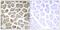 Solute Carrier Family 16 Member 12 antibody, PA5-39248, Invitrogen Antibodies, Immunohistochemistry paraffin image 