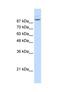 Matrin 3 antibody, NBP1-57359, Novus Biologicals, Western Blot image 