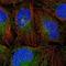 TNFAIP3 Interacting Protein 1 antibody, NBP1-90341, Novus Biologicals, Immunocytochemistry image 