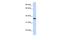 Lipocalin 12 antibody, PA5-44898, Invitrogen Antibodies, Western Blot image 